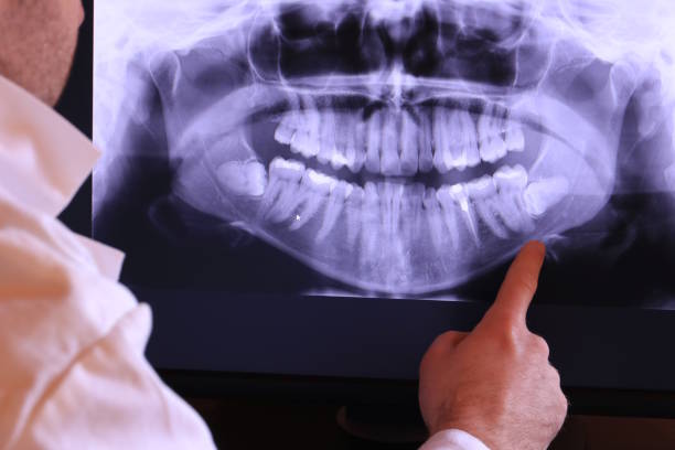 Best Knocked-Out Tooth Emergency  in Malvern, OH