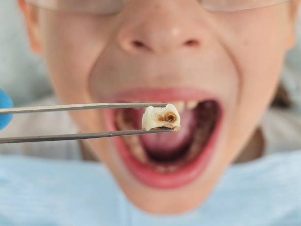 Best Cracked Tooth Emergency Dentist  in Malvern, OH