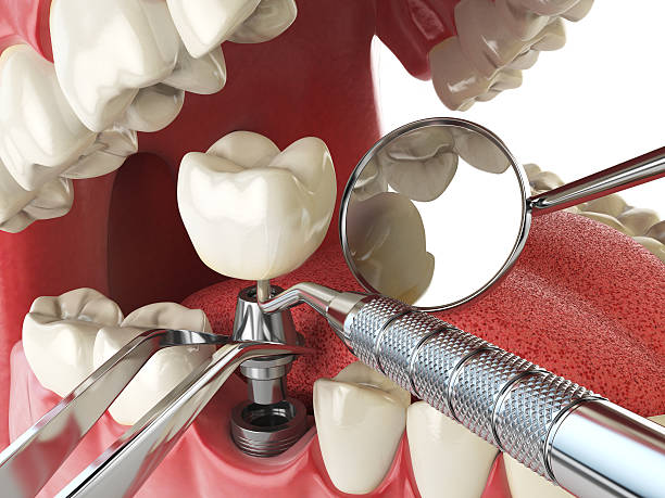 Best Urgent Tooth Repair  in Malvern, OH